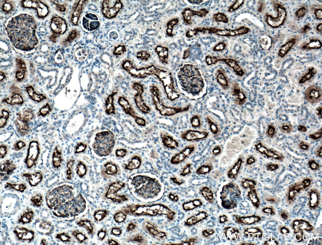 Immunohistochemistry (IHC) staining of human kidney tissue using MME,CD10 Monoclonal antibody (60034-3-Ig)