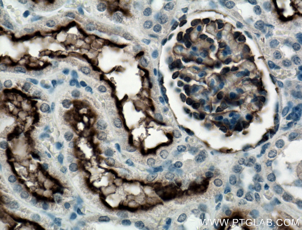 Immunohistochemistry (IHC) staining of human kidney tissue using MME,CD10 Monoclonal antibody (60034-3-Ig)