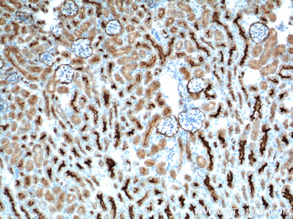 Immunohistochemistry (IHC) staining of mouse kidney tissue using MME,CD10 Monoclonal antibody (60034-3-Ig)