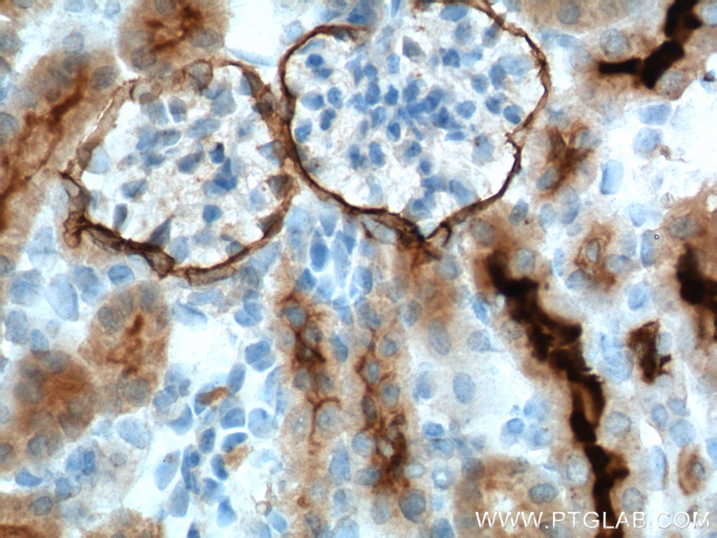 Immunohistochemistry (IHC) staining of mouse kidney tissue using MME,CD10 Monoclonal antibody (60034-3-Ig)
