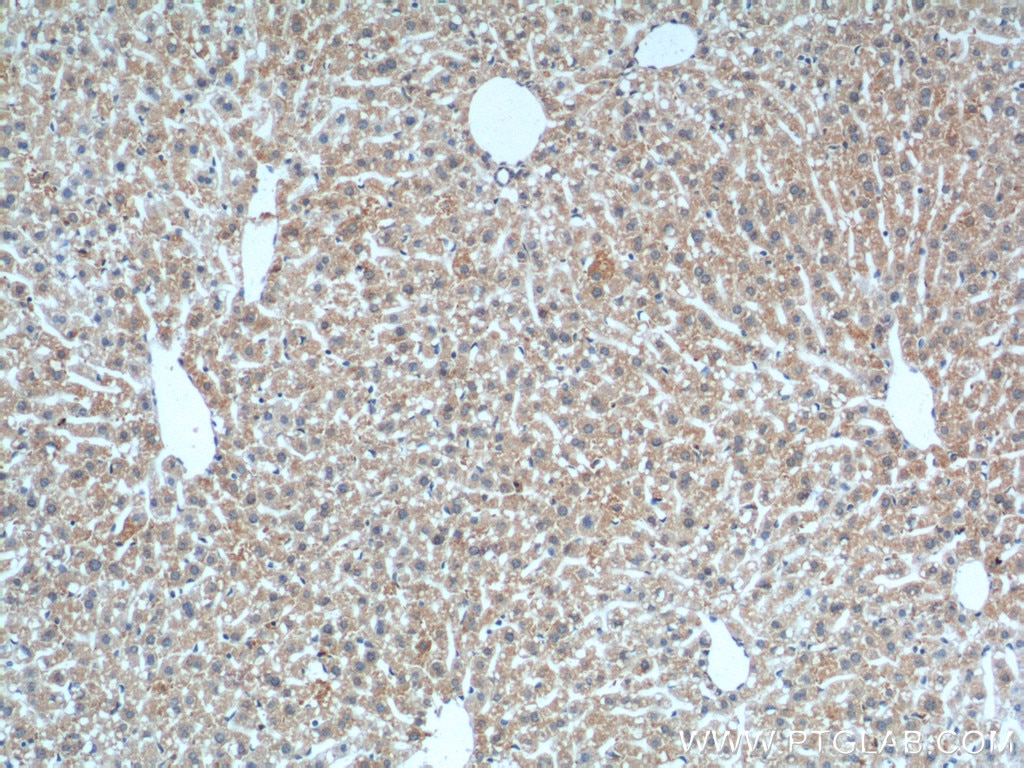 Immunohistochemistry (IHC) staining of mouse liver tissue using MME,CD10 Monoclonal antibody (60034-3-Ig)