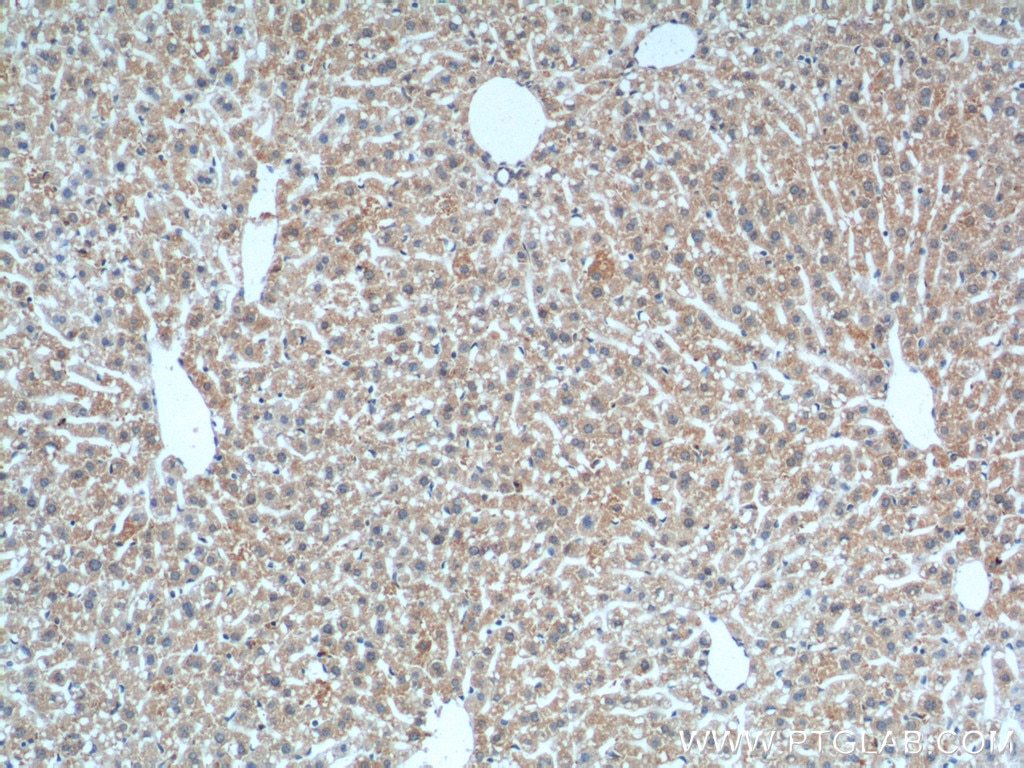 IHC staining of mouse liver using 60034-3-Ig