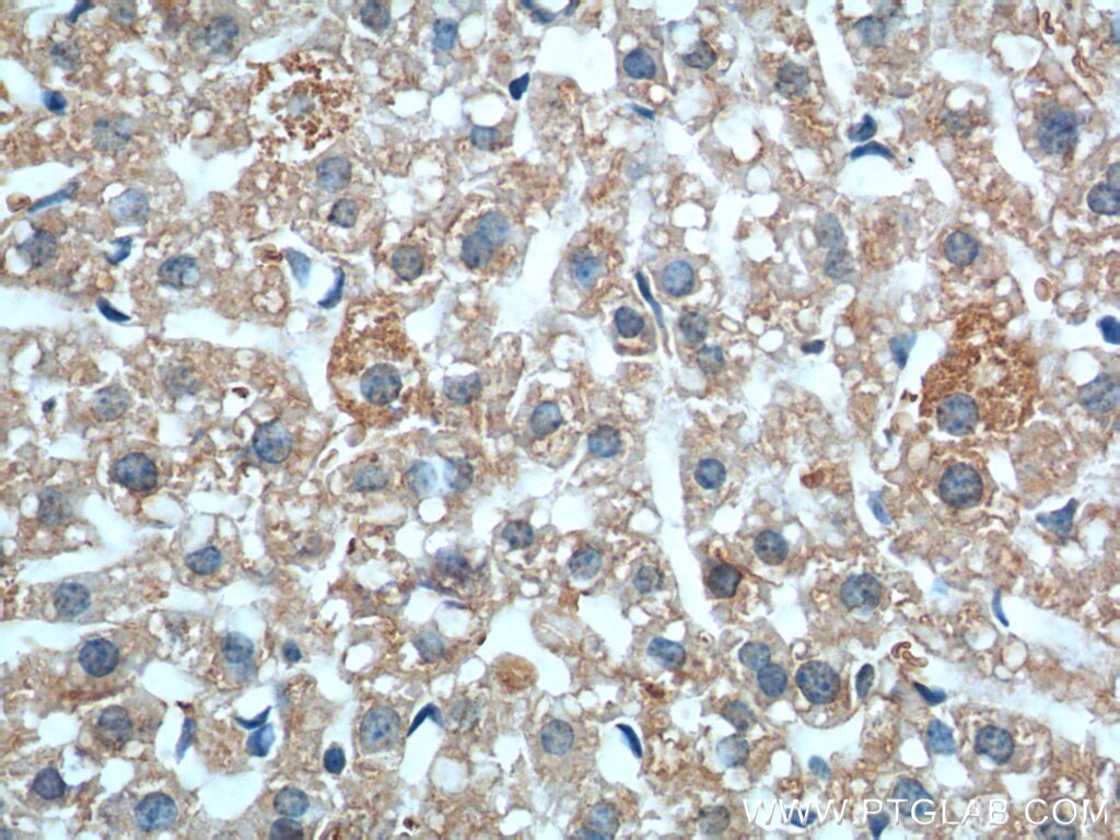 Immunohistochemistry (IHC) staining of mouse liver tissue using MME,CD10 Monoclonal antibody (60034-3-Ig)