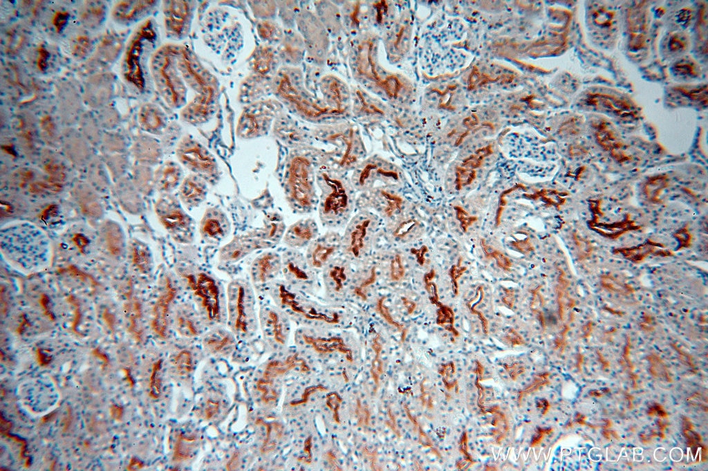 Immunohistochemistry (IHC) staining of human kidney tissue using MME,CD10 Monoclonal antibody (60034-3-Ig)