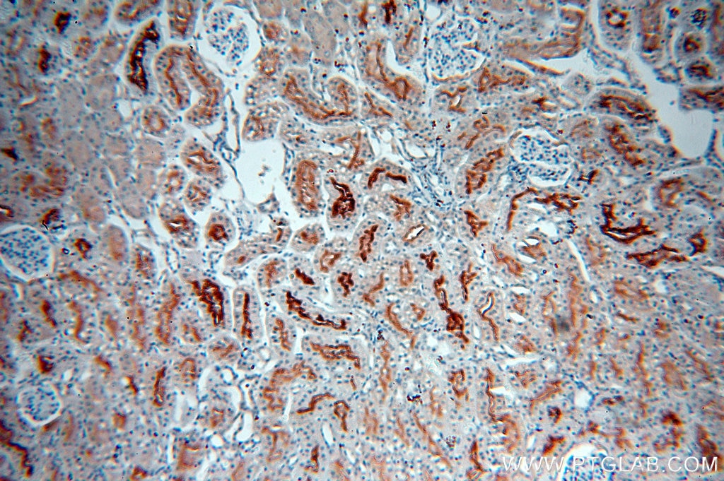 IHC staining of human kidney using 60034-3-Ig