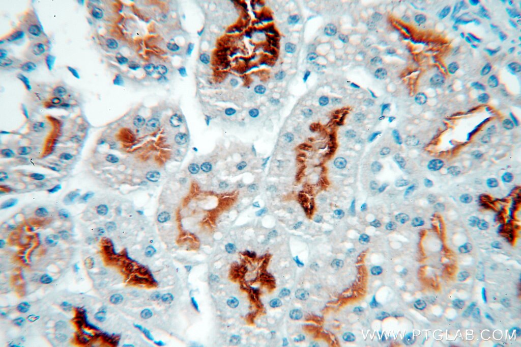 Immunohistochemistry (IHC) staining of human kidney tissue using MME,CD10 Monoclonal antibody (60034-3-Ig)