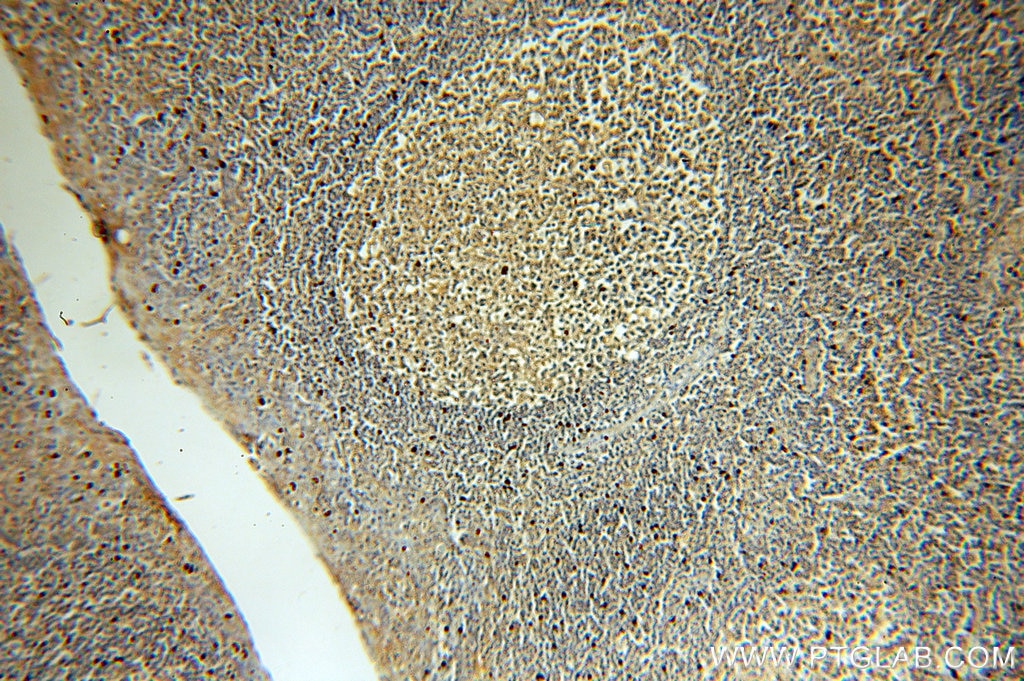 Immunohistochemistry (IHC) staining of human tonsil tissue using MME,CD10 Monoclonal antibody (60034-3-Ig)