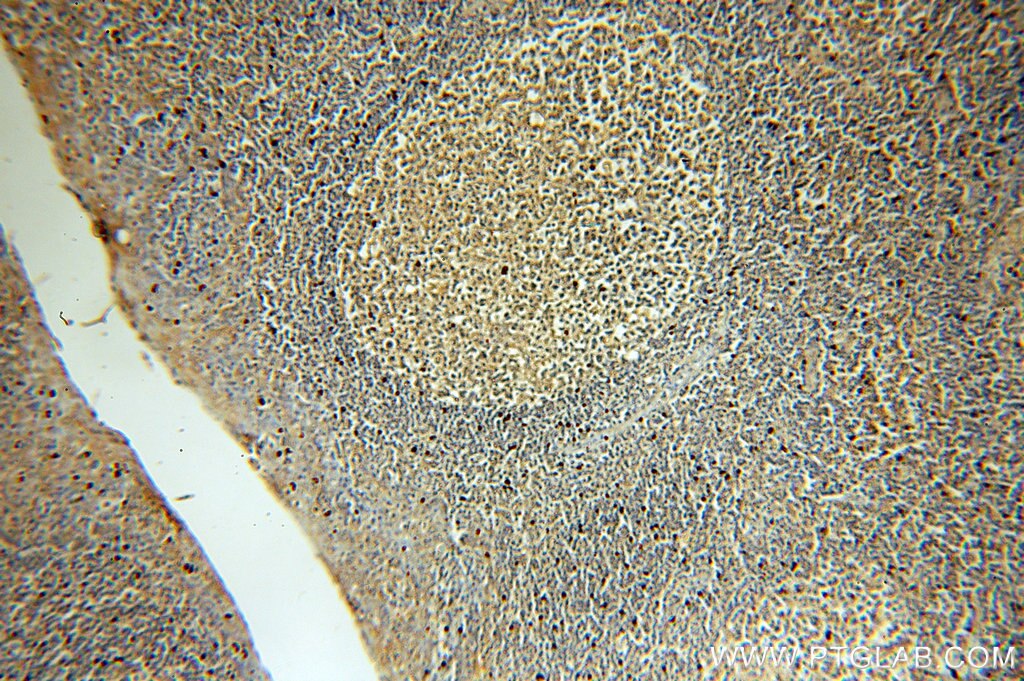 IHC staining of human tonsil using 60034-3-Ig