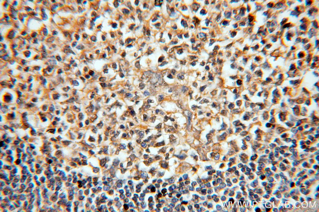 Immunohistochemistry (IHC) staining of human tonsil tissue using MME,CD10 Monoclonal antibody (60034-3-Ig)