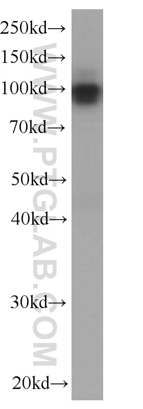 Western Blot (WB) analysis of pig kidney tissue using MME,CD10 Monoclonal antibody (60034-3-Ig)