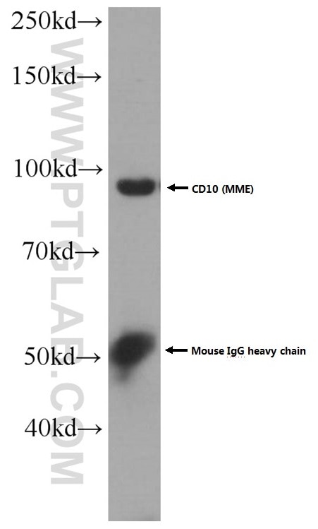 WB analysis of mouse kidney using 60034-3-Ig