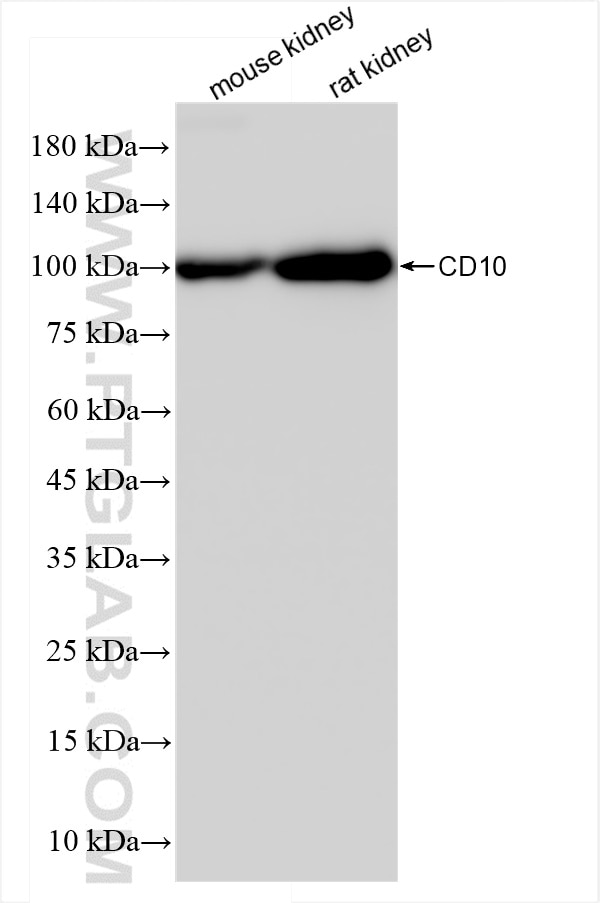 Western Blot (WB) analysis of various lysates using MME,CD10 Recombinant antibody (84181-4-RR)