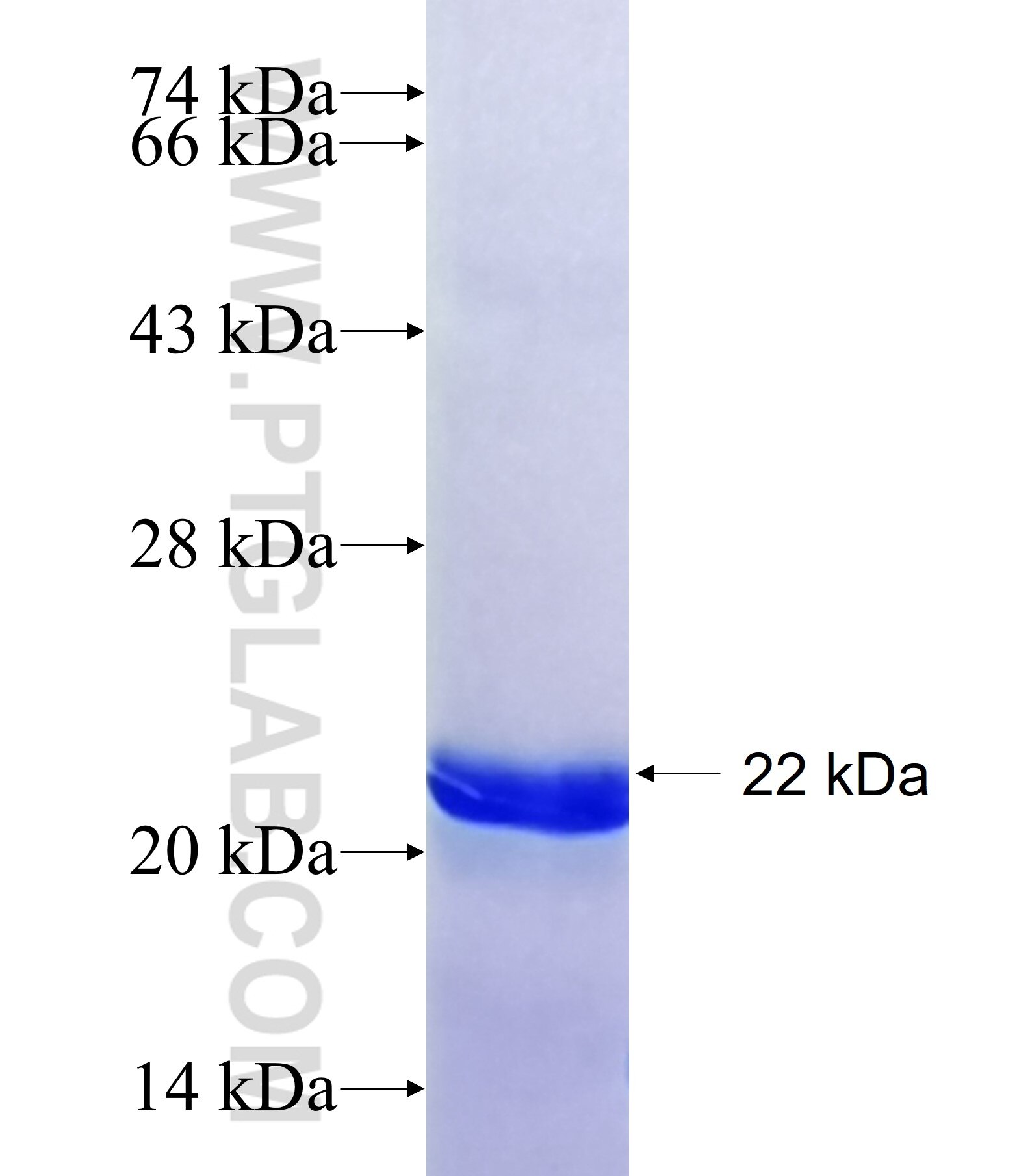 MMEL1 fusion protein Ag35864 SDS-PAGE MMEL1 fusion protein Ag35864 SDS-PAGE