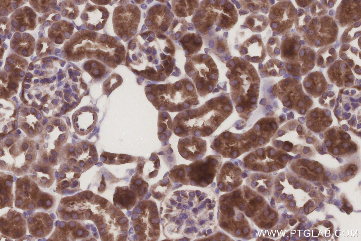 Immunohistochemistry (IHC) staining of mouse kidney tissue using MMGT1 Polyclonal antibody (31166-1-AP)
