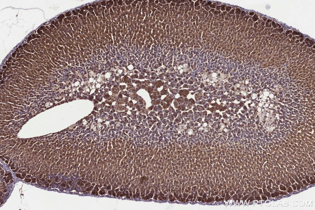 IHC staining of mouse adrenal gland using 31166-1-AP Immunohistochemistry (IHC) staining of mouse adrenal gland tissue using MMGT1 Polyclonal antibody (31166-1-AP)