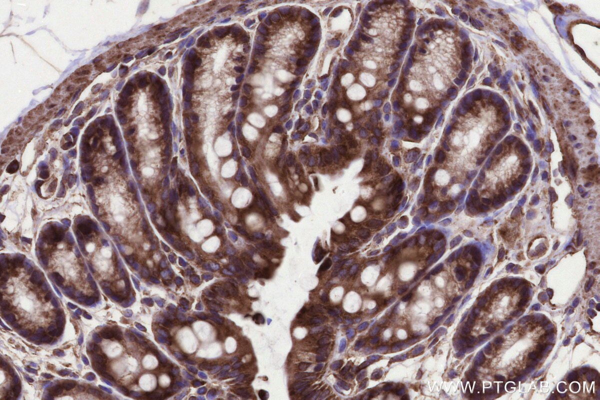 IHC staining of mouse colon using 31166-1-AP Immunohistochemistry (IHC) staining of mouse colon tissue using MMGT1 Polyclonal antibody (31166-1-AP)