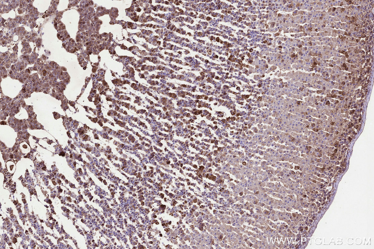 Immunohistochemistry (IHC) staining of rat adrenal gland tissue using MMGT1 Polyclonal antibody (31166-1-AP)