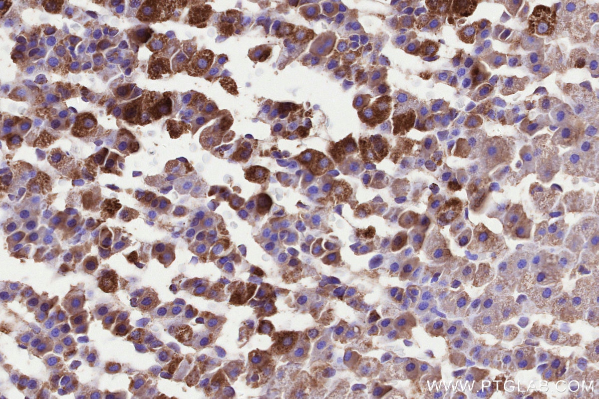 Immunohistochemistry (IHC) staining of rat adrenal gland tissue using MMGT1 Polyclonal antibody (31166-1-AP)