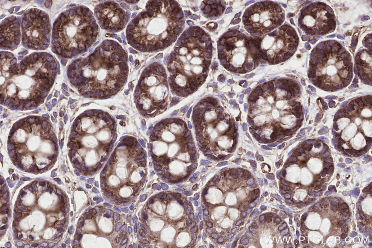 IHC staining of rat colon using 31166-1-AP Immunohistochemistry (IHC) staining of rat colon tissue using MMGT1 Polyclonal antibody (31166-1-AP)
