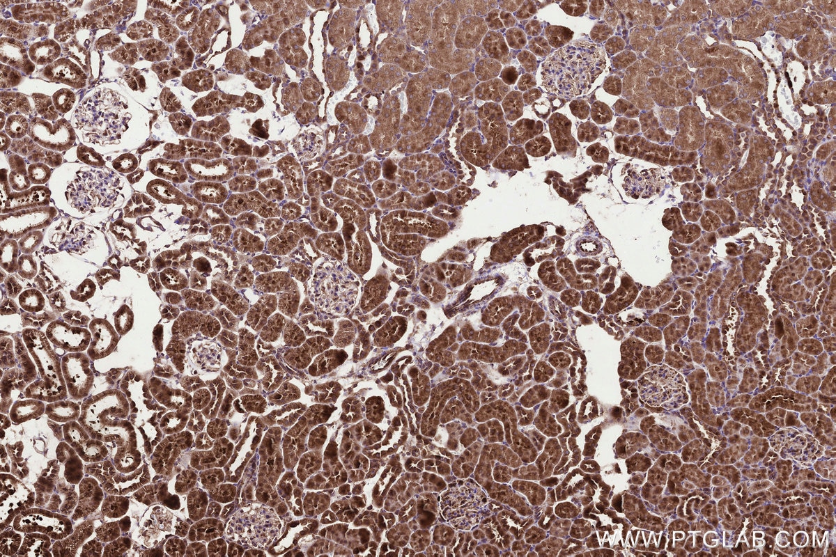 IHC staining of rat kidney using 31166-1-AP Immunohistochemistry (IHC) staining of rat kidney tissue using MMGT1 Polyclonal antibody (31166-1-AP)