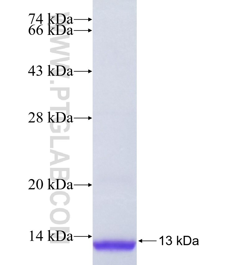 MMGT1 fusion protein Ag35580 SDS-PAGE