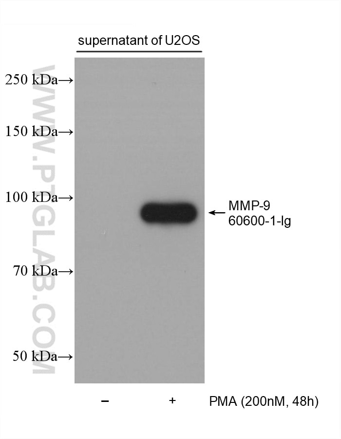 Western Blot (WB) analysis of various lysates using MMP-9 Monoclonal antibody (60600-1-Ig)