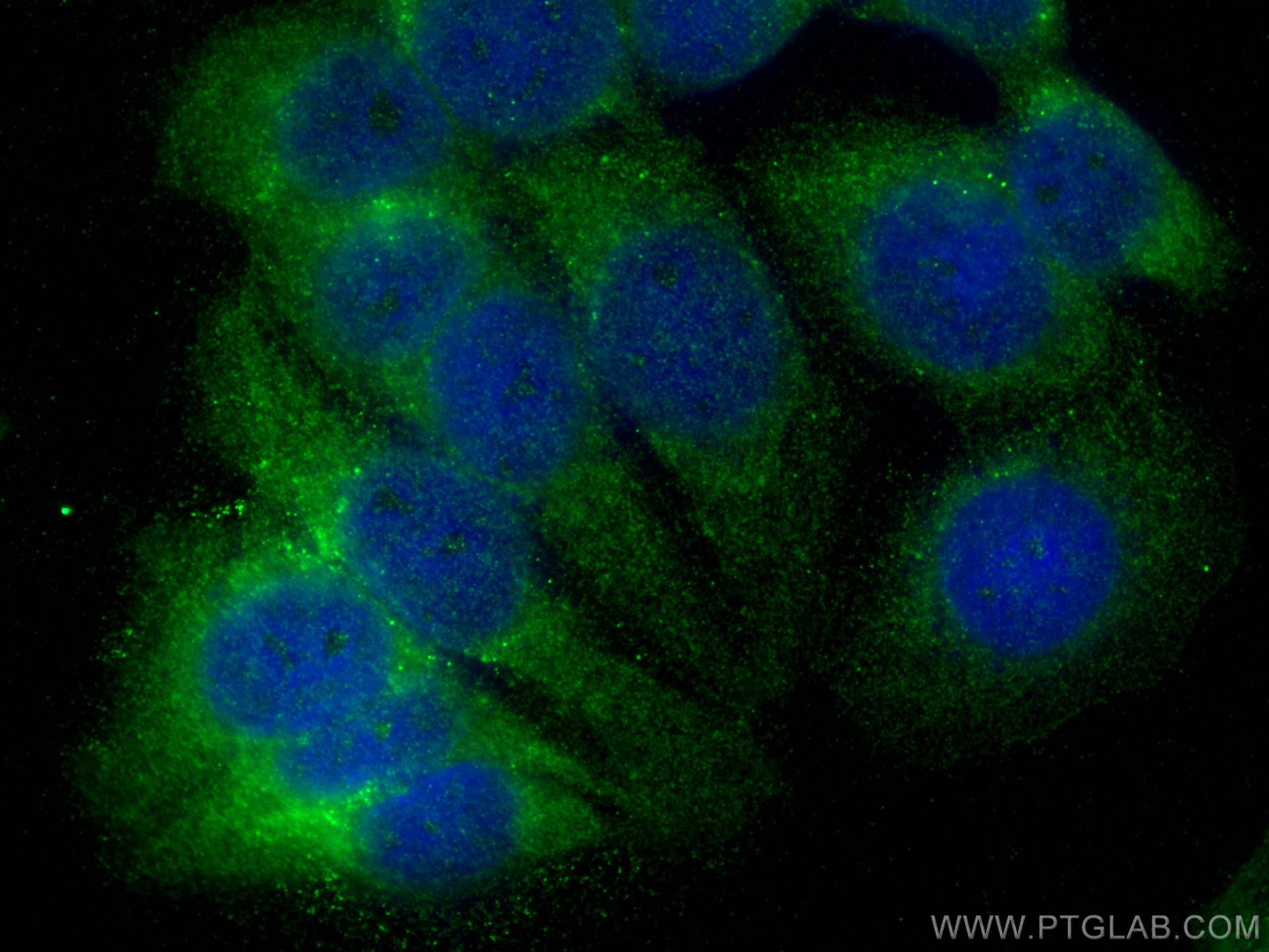 Immunofluorescence (IF) / fluorescent staining of MCF-7 cells using MMP1 Polyclonal antibody (10371-2-AP)