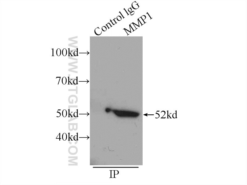 MMP1 Polyclonal antibody