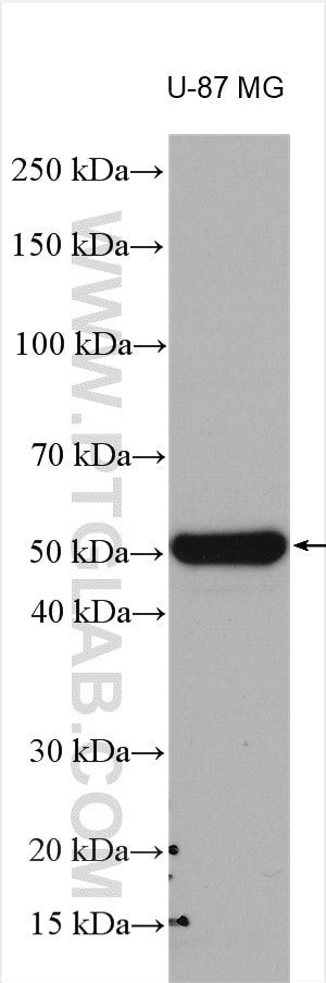 Western Blot (WB) analysis of various lysates using MMP1 Polyclonal antibody (10371-2-AP)