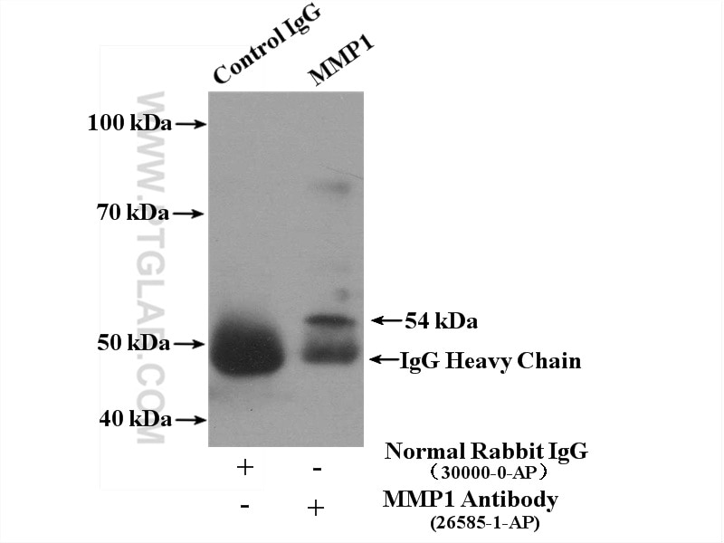 Immunoprecipitation (IP) experiment of Raji cells using MMP1 Polyclonal antibody (26585-1-AP)
