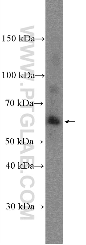 Western Blot (WB) analysis of A375 cells using MMP1 Polyclonal antibody (26585-1-AP)