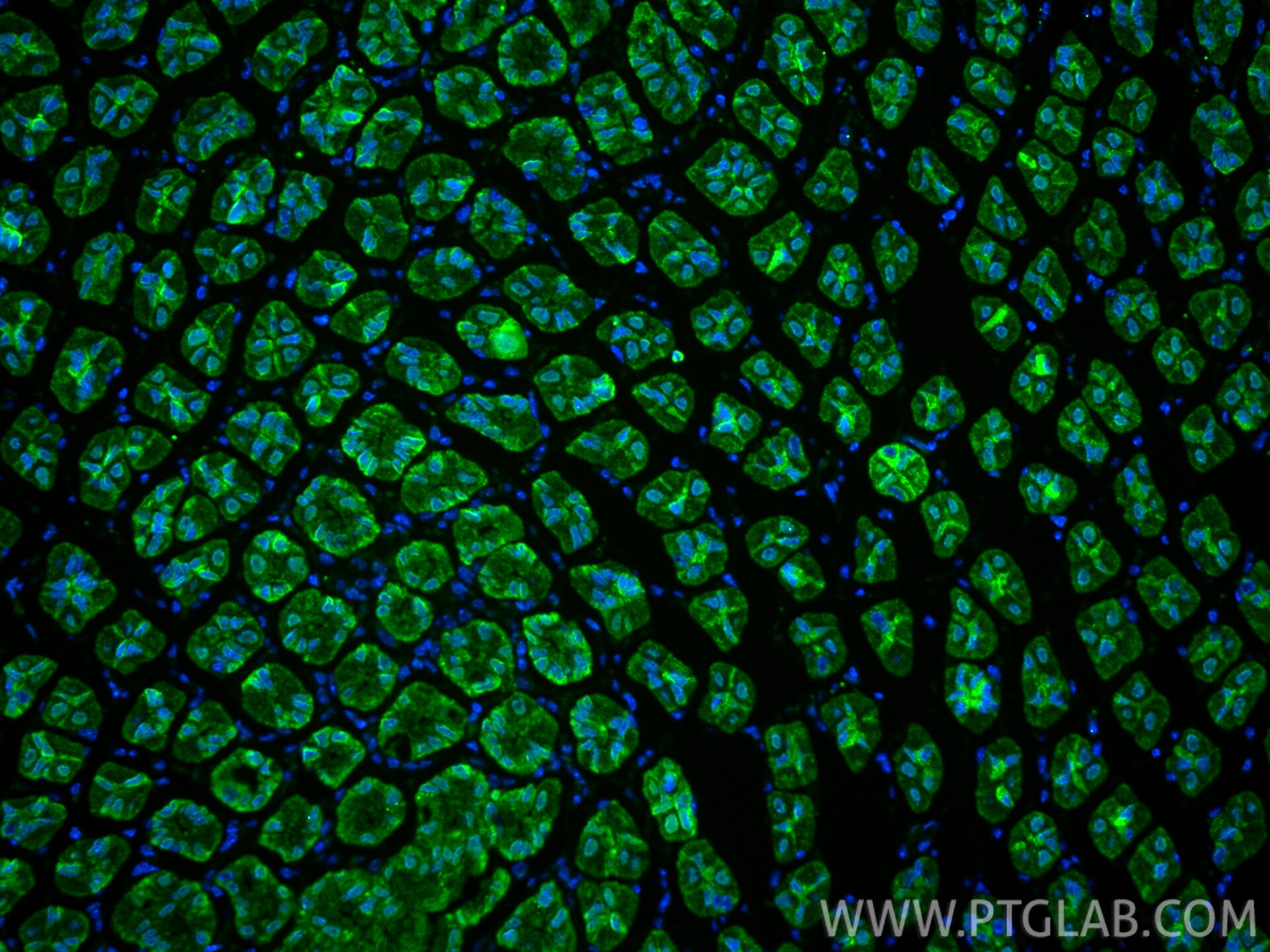 Immunofluorescence (IF) / fluorescent staining of mouse stomach tissue using MMP1 Polyclonal antibody (30805-1-AP)