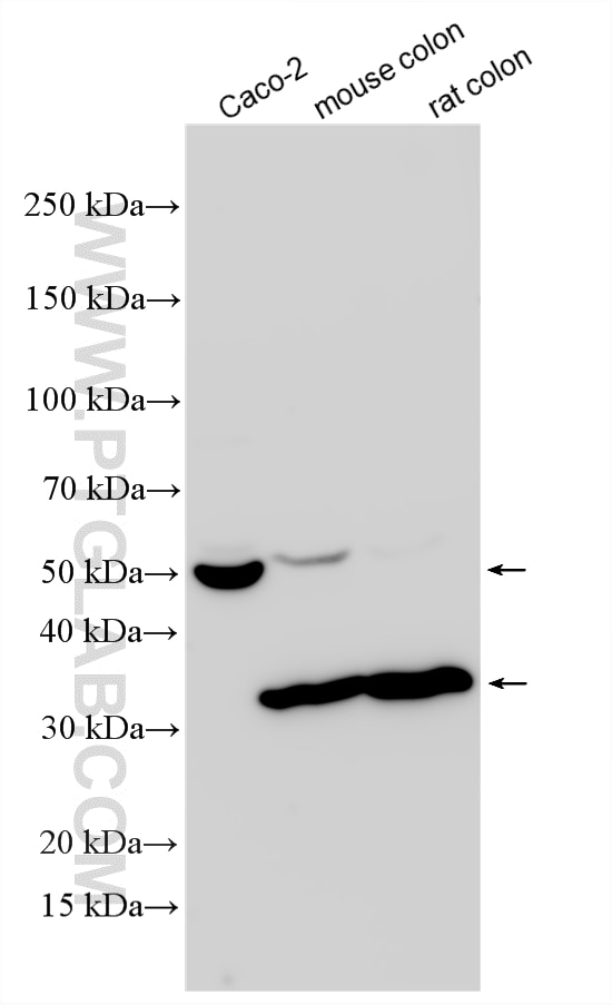 Various lysates were subjected to SDS PAGE followed by western blot with 30805-1-AP (MMP1 antibody) at dilution of 1:2000 incubated at room temperature for 1.5 hours. Western Blot (WB) analysis of various lysates using MMP1 Polyclonal antibody (30805-1-AP)