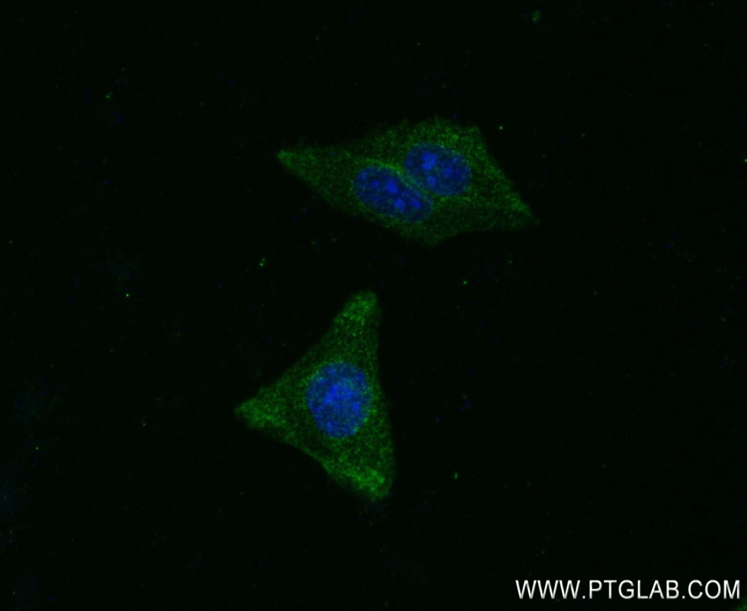 Immunofluorescence (IF) / fluorescent staining of HepG2 cells using MMP1 Recombinant antibody (83114-2-RR)