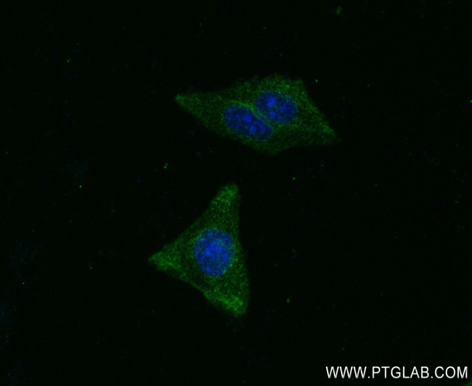 IF Staining of HepG2 using 83114-2-RR