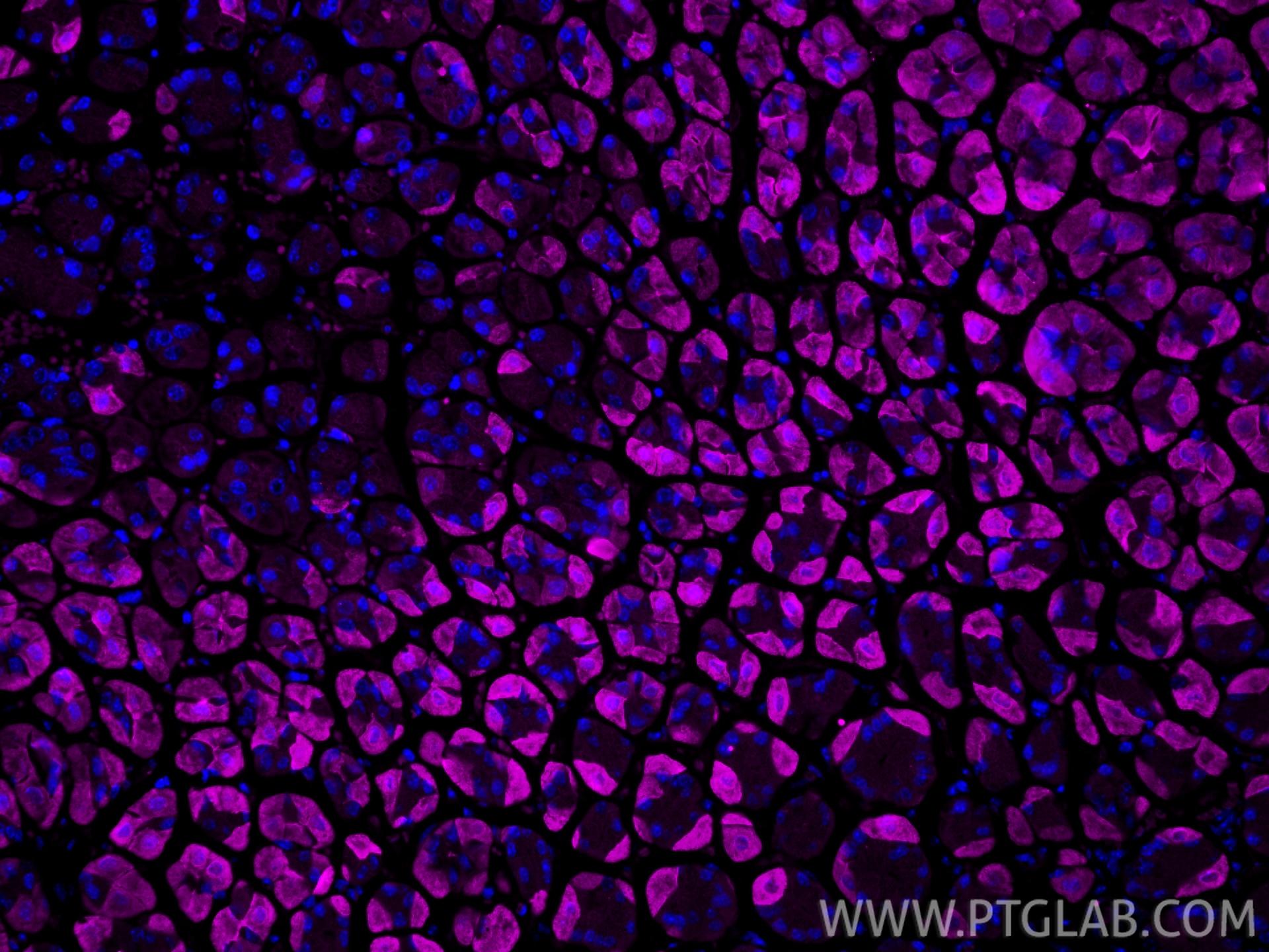 Immunofluorescent analysis of (4% PFA) fixed paraffin-embedded mouse stomach tissue using CoraLite® Plus 647 MMP1 antibody (CL647-10371) at dilution of 1:200. Heat mediated antigen retrieval with Tris-EDTA buffer (pH 9.0). Immunofluorescence (IF) / fluorescent staining of mouse stomach tissue using CoraLite® Plus 647-conjugated MMP1 Polyclonal anti (CL647-10371)