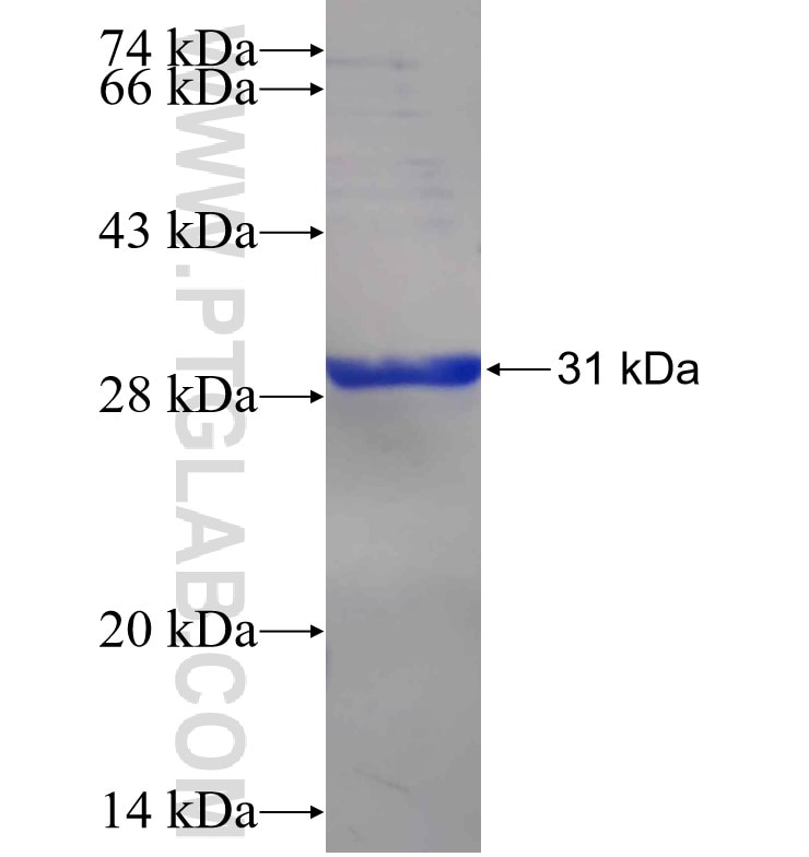 MMP1 fusion protein Ag25073 SDS-PAGE