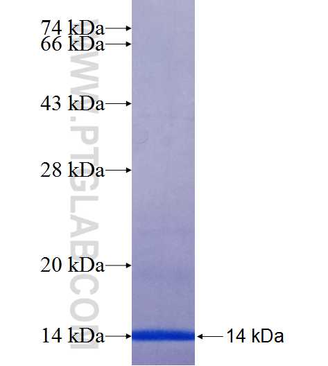 MMP1 fusion protein Ag25809 SDS-PAGE