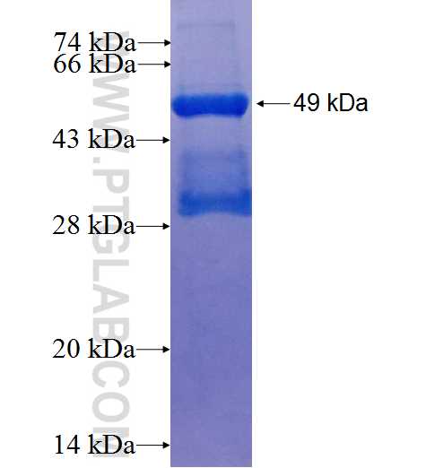 MMP1 fusion protein Ag0547 SDS-PAGE