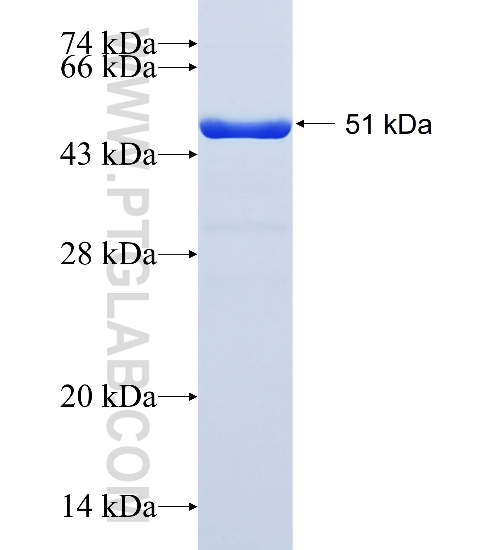 MMP10 fusion protein Ag41746 SDS-PAGE