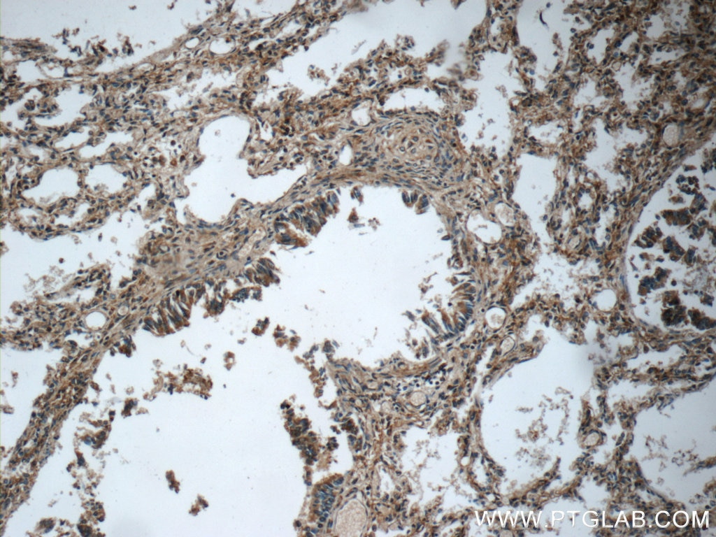 Immunohistochemistry (IHC) staining of human lung tissue using MMP12 Polyclonal antibody (22989-1-AP)