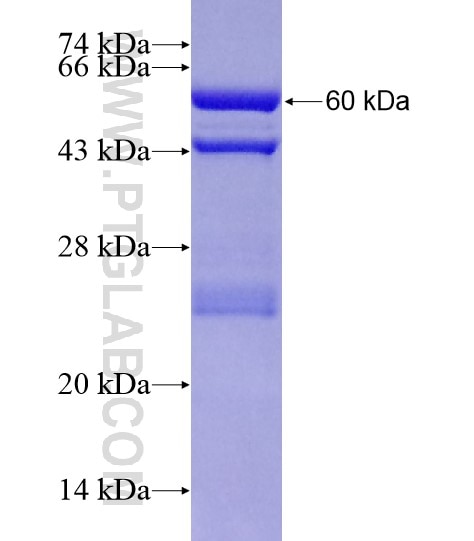MMP12 fusion protein Ag19549 SDS-PAGE