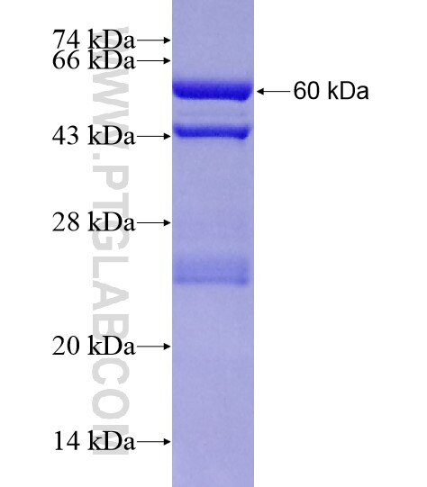 MMP12 fusion protein Ag19549 SDS-PAGE MMP12 fusion protein Ag19549 SDS-PAGE