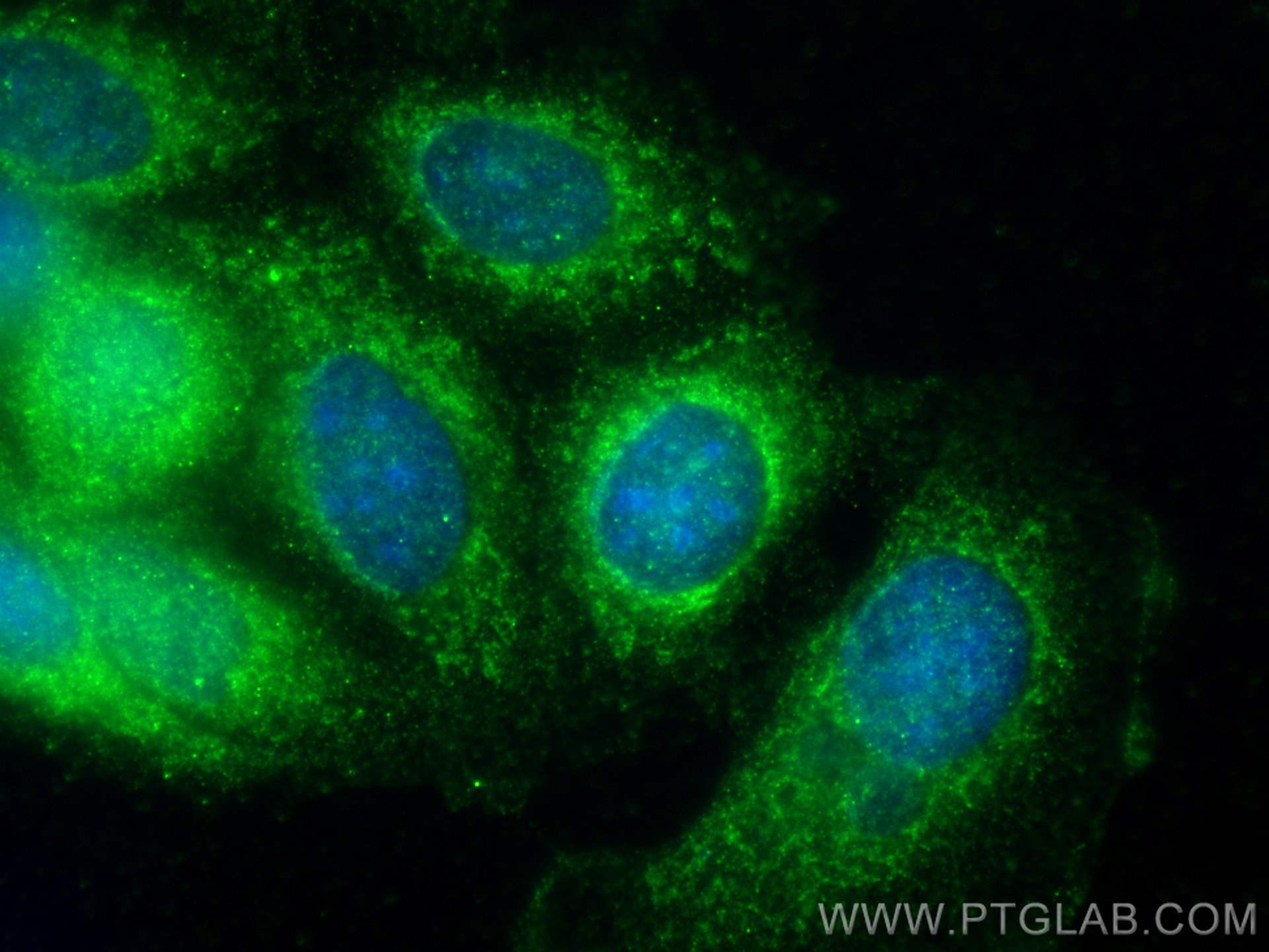 Immunofluorescence (IF) / fluorescent staining of MCF-7 cells using MMP13 Polyclonal antibody (18165-1-AP)