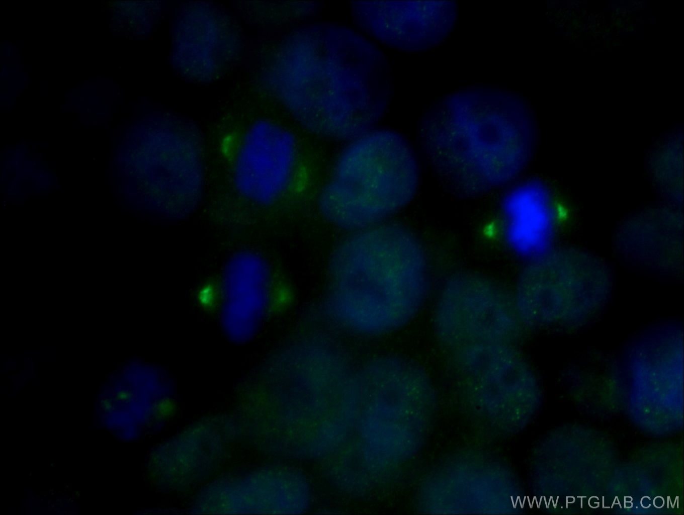 IF Staining of MCF-7 using 18165-1-AP