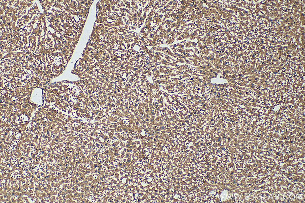 Immunohistochemistry (IHC) staining of mouse liver tissue using MMP13 Polyclonal antibody (18165-1-AP)