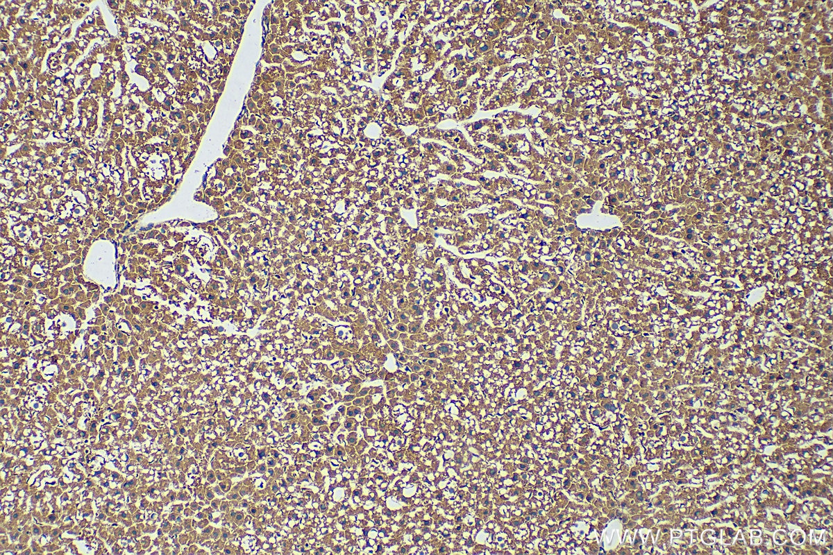 IHC staining of mouse liver using 18165-1-AP