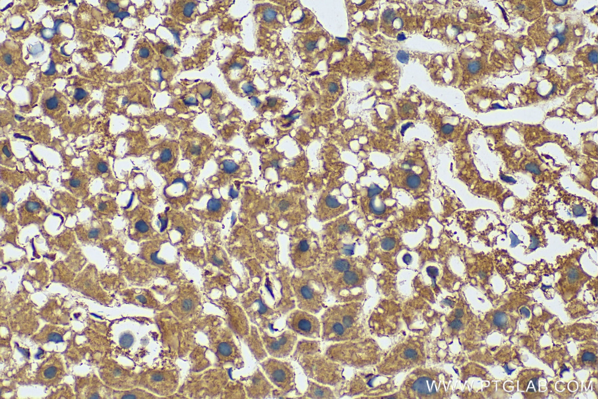 Immunohistochemistry (IHC) staining of mouse liver tissue using MMP13 Polyclonal antibody (18165-1-AP)