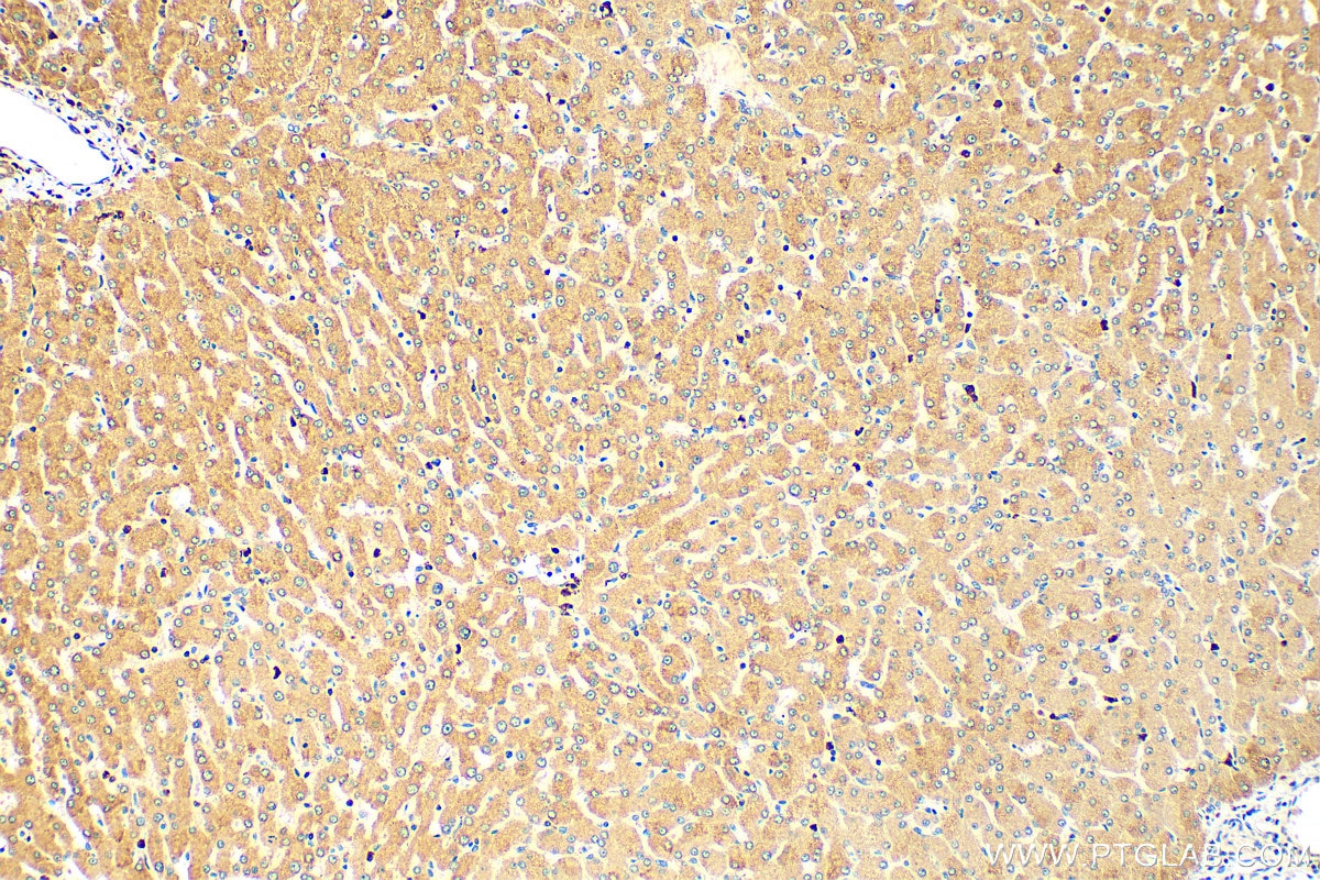 Immunohistochemistry (IHC) staining of human liver tissue using MMP13 Polyclonal antibody (18165-1-AP)