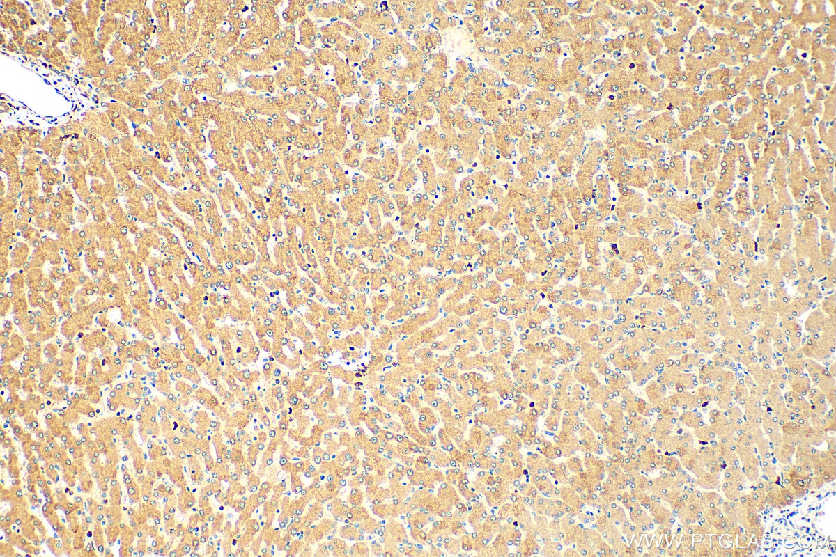 IHC staining of human liver using 18165-1-AP